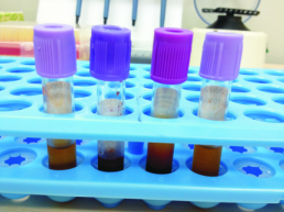 Ҷ���л���ܼ���Լ��У�MTHFR��MTRR�� 